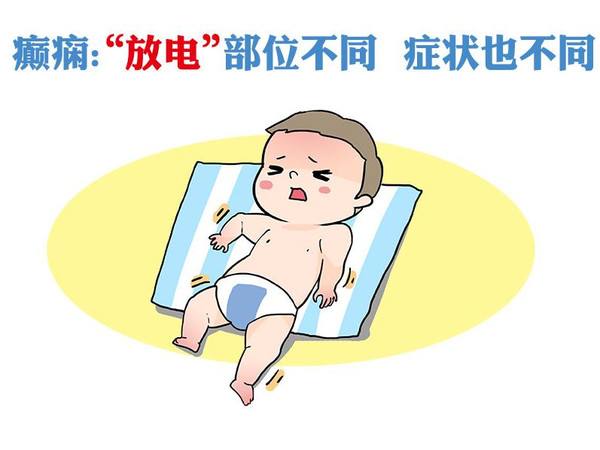 小孩患癫痫不治疗会怎样?经颅磁治疗癫痫