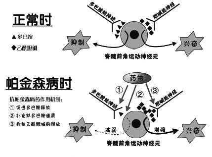 经颅磁的治疗_帕金森病的康复训练有哪些