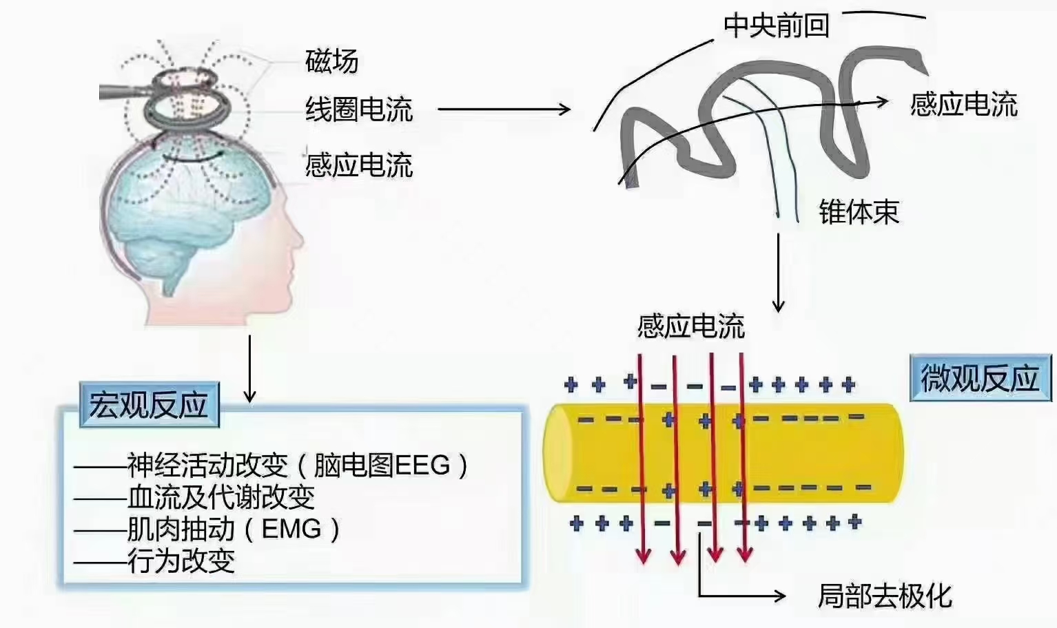 择思达斯磁疗_注意力不集中容易走神是什么表现