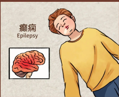 家用经颅磁刺激仪器_癫疯病和羊癫疯一样吗 