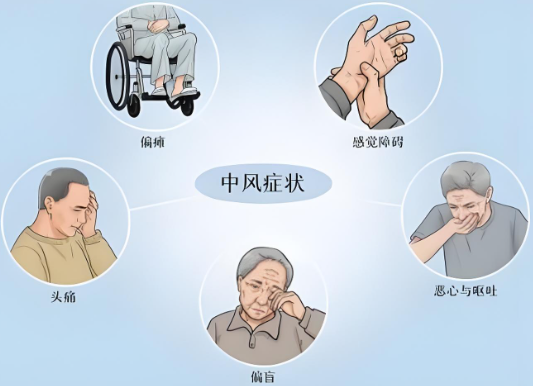 南京择思达斯_中风有什么后遗症吗怎么治疗