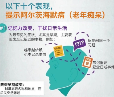 家用择思达斯_阿尔茨海默症看世界是什么样的?